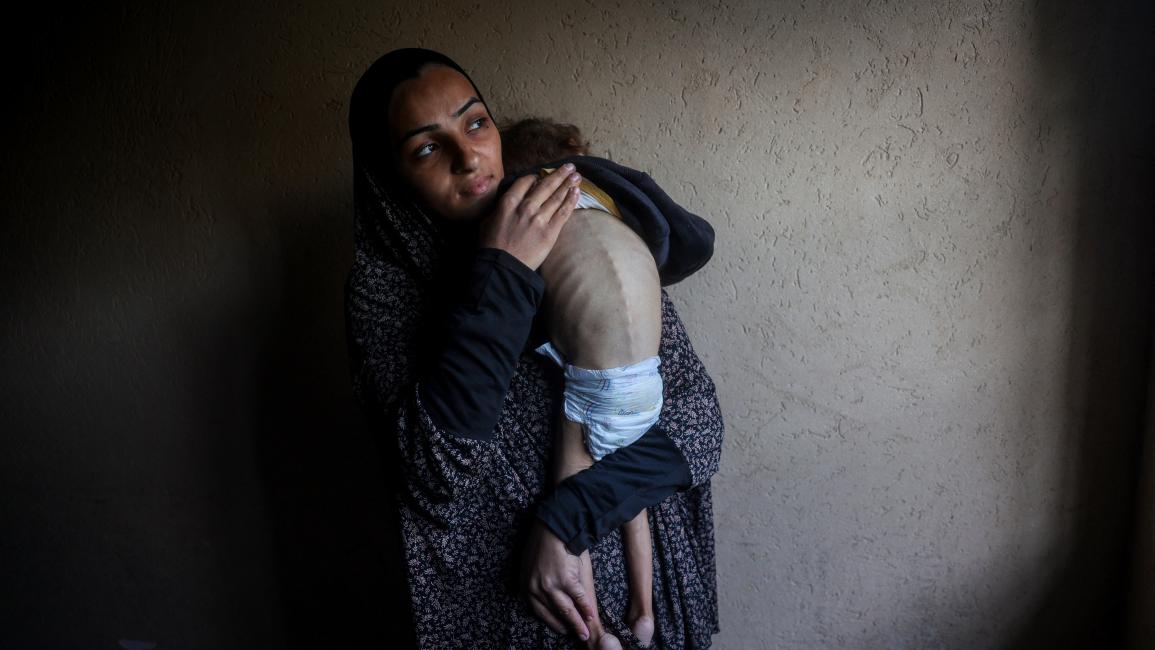 326 فلسطينياً بغزة استشهدوا بسبب سوء التغذية ونقص الغذاء والدواء