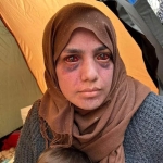 عيون غارقة بالدم… صورة تهز المشاعر لكنها ليست في غزة