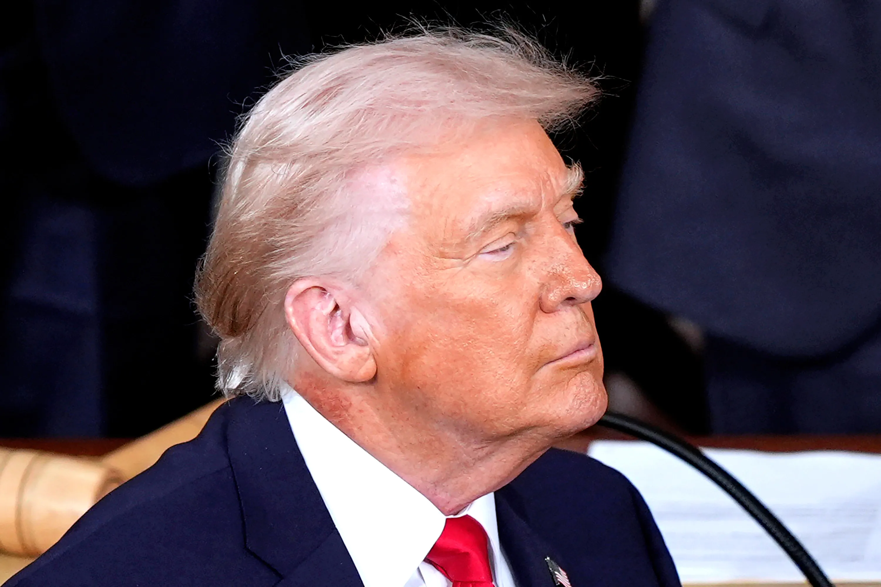 غموض يحيط بصحة ترمب وظهور طفح جلدي يثير القلق