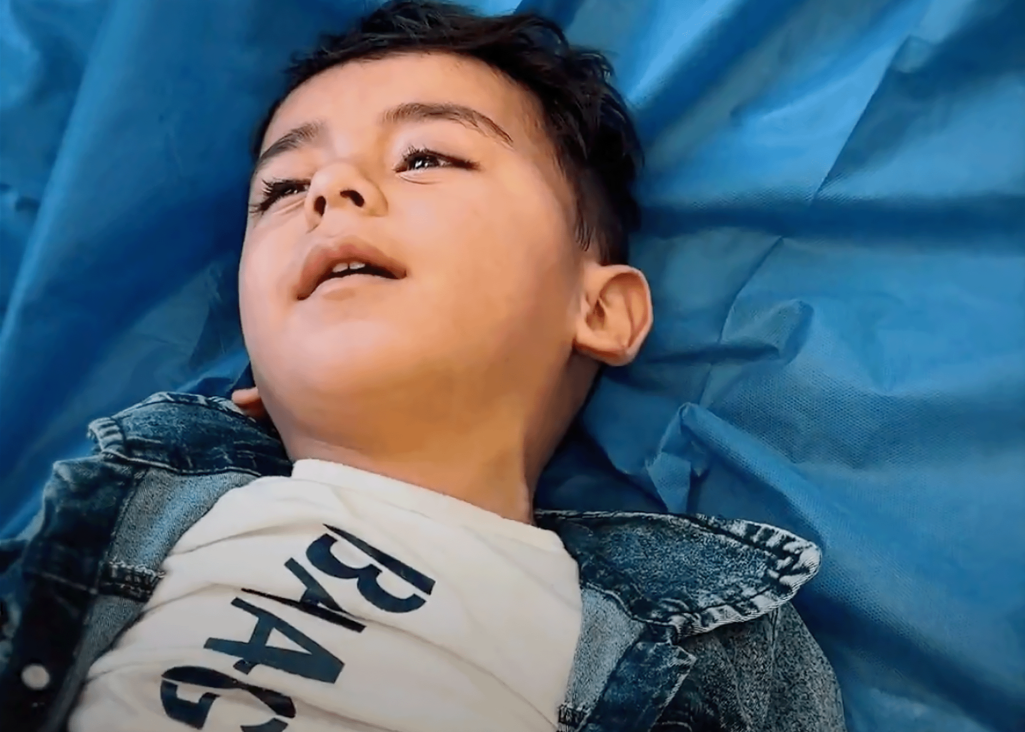 معجزة طبية في غزة: إنقاذ طفل من شبح الإعاقة